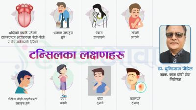 डा. ढुण्डिराज पौडेलको सल्लाह : टन्सिल संक्रमणबाट कसरी बच्ने