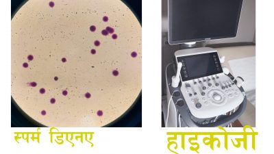 वात्सल्यले ल्यायो हाइकोजी र स्पर्म डिएनए फ्रेगमेन्टेसन इन्डेक्सजस्ता अत्याधुनिक प्रविधी