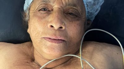 नर्भिकमा मधुमेह पीडित ८१ वर्षीया वृद्धाको दूरबीनबाट सफल शल्यक्रिया