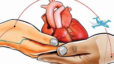 मुटुलाई कमजोर पार्ने पल्मोनरी हाइपरटेन्सन कस्तो रोग ?