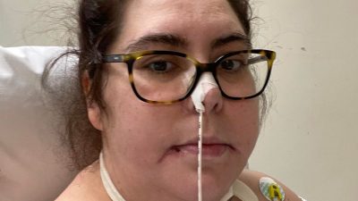 कोभिडले थलिएर कोमामा पुगेकी नर्सको भियग्राले बचायो ज्यान