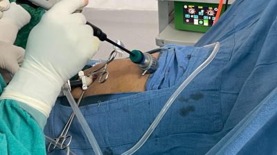 त्रिशुली अस्पतालमा ल्याप्रोकोपीक सर्जरी सेवा सुरु, एकै दिन तीन जनाको&hellip;