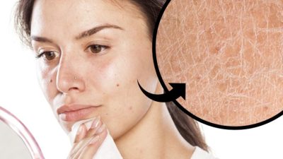 अत्याधिक मेकअपले अनुहारमा जोखिम