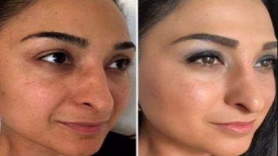 वैज्ञानिकको नयाँ उपलब्धि : ५३ वर्षीया महिलाको अनुहार ३० वर्षको&hellip;