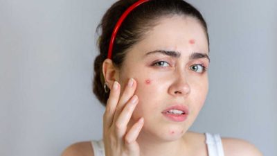 एभरेष्ट अस्पतालले नारी दिवसको दिन नि:शुल्क स्वास्थ्य शिविर सञ्चालन गर्ने