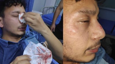 डाक्टरमाथि कुटपिट गर्ने ट्राफिक प्रहरी निलम्बनमा