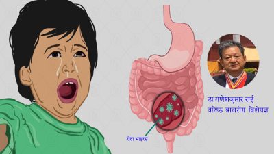 चिसोमा रोटा भाइरसले सताउला बच्चालाई !