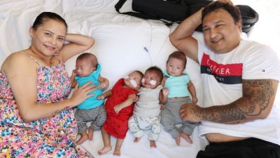 नर्भिकको आइभिएफमा उपचार गरेकी सिंहले अष्ट्रेलियामा जन्माइन् चम्ल्याहा