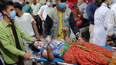 जलनका बिरामीलाई उपचार पाउनै सास्ती